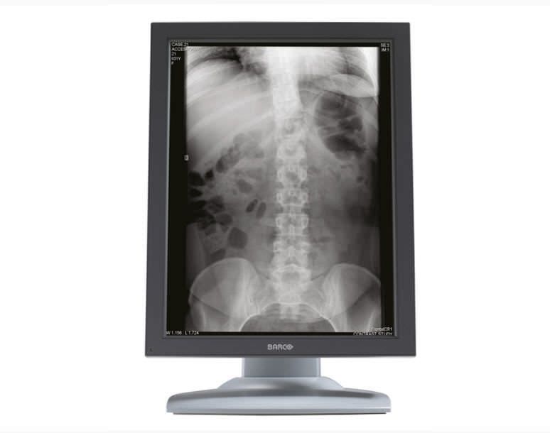 LCD display / monochrome / medical / diagnostic 3 MP | Nio E-3620 MA Barco