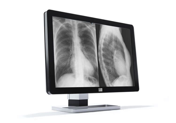 Monochrome display / LCD / medical / mammography 10 MP | Coronis Fusion K9601618 Barco