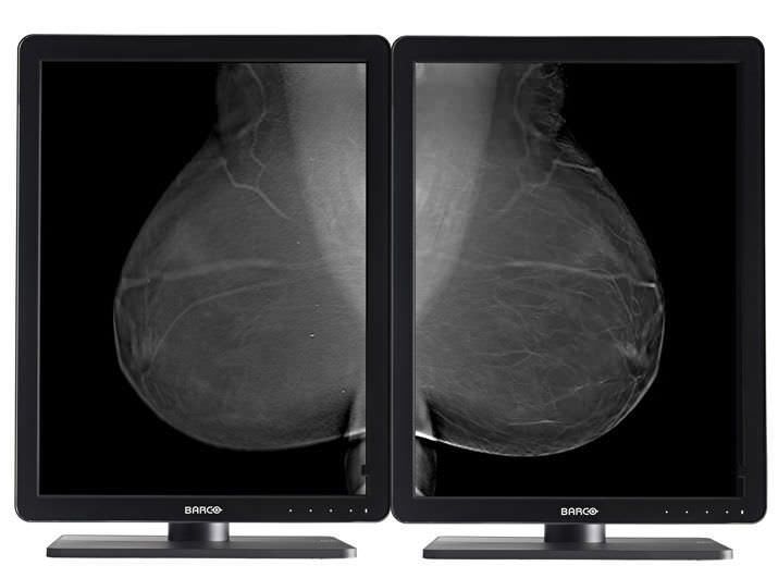 Monochrome display / LED / mammography / diagnostic 5 MP | Nio MDNG-5221 Barco