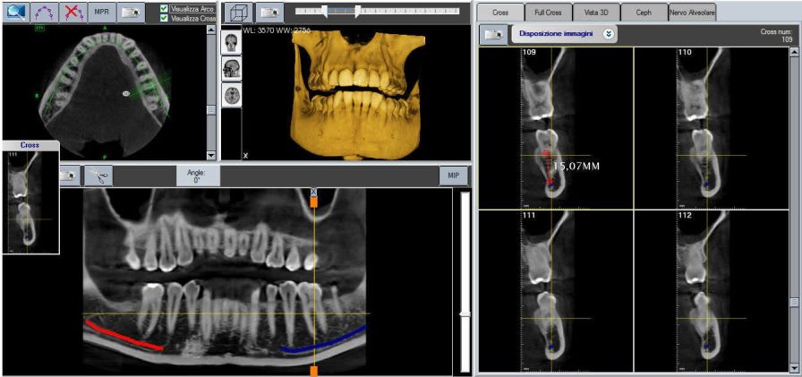 Panoramic X-ray system (dental radiology) / cephalometric X-ray system / digital X-View PANORAMICO 2D-CEPH Trident