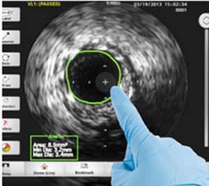Analysis software / for intravascular ultrasound imaging CORE™ Volcano