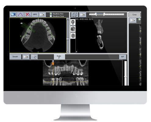 Viewing software / acquisition / analysis / for dental imaging Deep View ® Trident