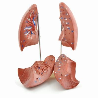 Lung anatomical model H130367 RÜDIGER - ANATOMIE