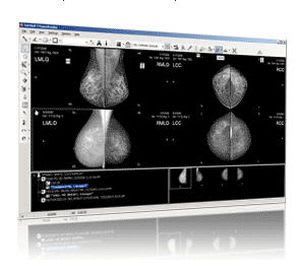 Gateway medical imaging Mammo Viewer RamSoft