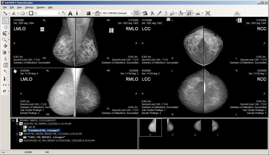 Viewing software / for mammography Mammo Viewer RamSoft