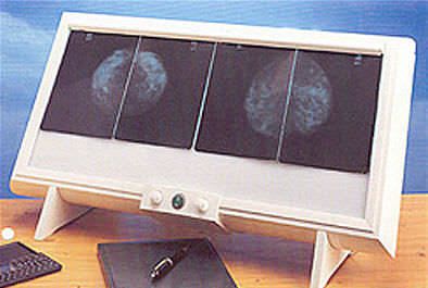 White light X-ray film viewer / multi-section / for mammography / variable-speed MSBX-6 Ordisi