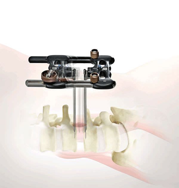 Orthopedic surgery retractor / for minimally invasive surgery / spine RAVINE® K2M