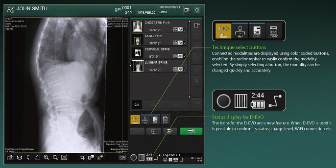 Anatomical imaging computer workstation / radiography / medical CONSOLE ADVANCE FUJIFILM Europe