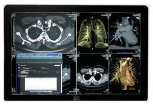 Archiving transmission system SYNAPSE® FUJIFILM Europe