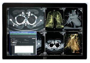 Radiology information system RIS SYNAPSE® FUJIFILM Europe