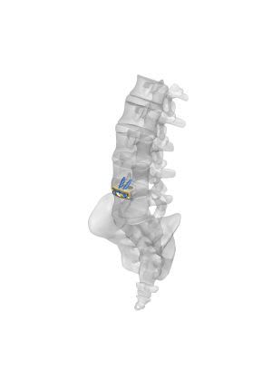 Thoraco-lumbar interbody fusion cage / anterior Medacta