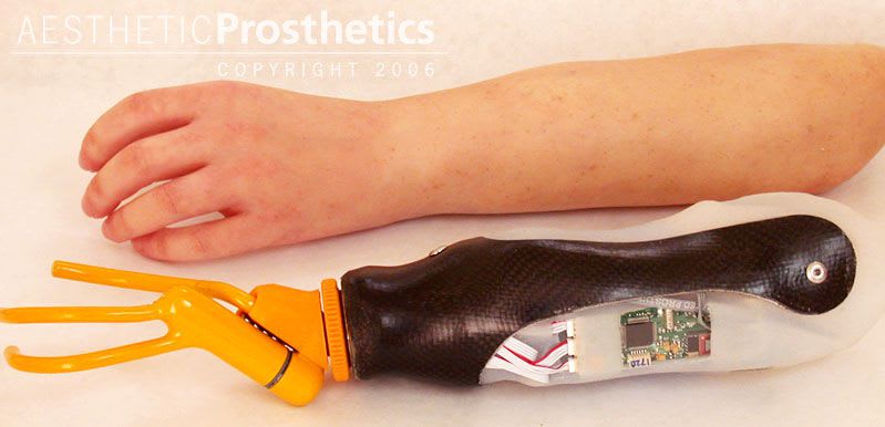 Hand prosthesis (upper extremity) / body-powered / hook clamp / adult Aesthetic Prosthetics