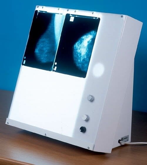 White light X-ray film viewer / 4-section / for mammography / variable-speed SKMS Wardray Premise