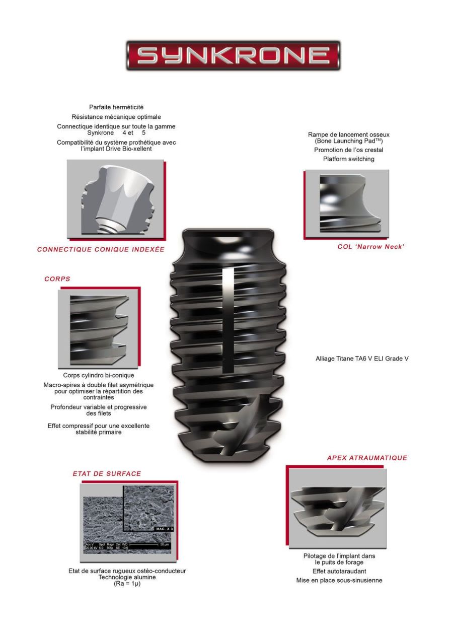 Cylindrical bi-conical dental implant / post-extraction Synkrone Drive Dental Implants