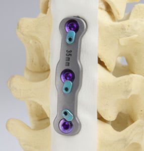 Cervical arthrodesis plate / anterior / 2 levels Simplicity® SOLO Precision Spine