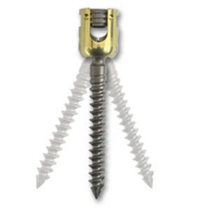 Polyaxial pedicle screw / not absorbable SureLOK™ Precision Spine