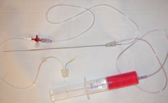 Ovocytarian puncture needle STEINER-TAN IVFETFLEX