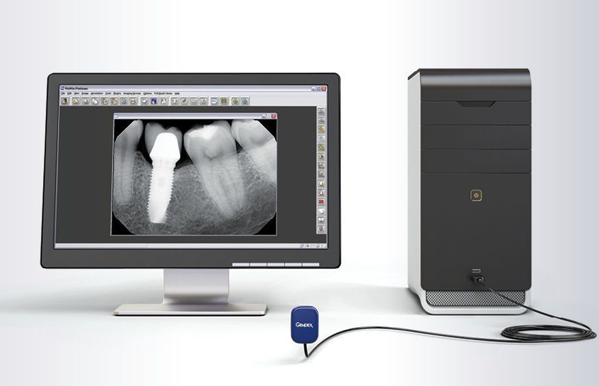 Dental radiography flat panel detector GXS-700™ Gendex Dental Systems