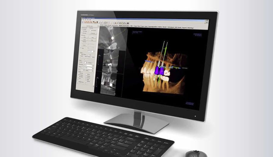 3D viewing software / for dental imaging INVIVO 5.3 Gendex Dental Systems