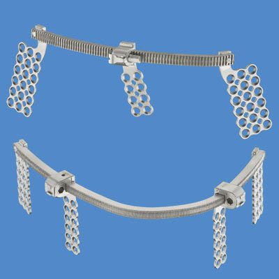 Mandibular distractor / internal CBX1010 Ningbo Cibei Medical Treatment Appliance