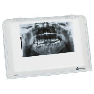 White light X-ray film viewer / 1-section / dental Luna CRISTOFOLI EQUIPAMENTOS de SEGURANCA - LTdA