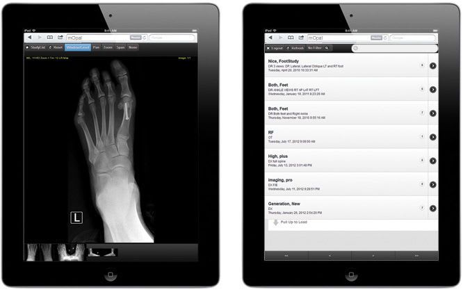 Medical imaging iOS application / for PACS mOpal 20/20 Imaging