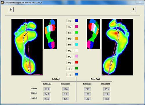 Viewing software / analysis / rehabilitation footscan® 7 RSscan International