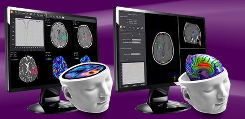 3D viewing software / diagnostic / for neuroimaging / medical Brain tumor diagnosis suite Olea Medical