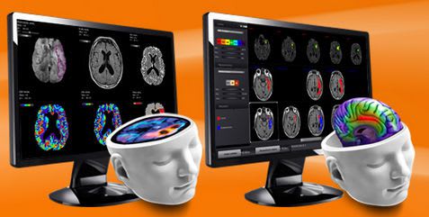 3D viewing software / diagnostic / for neuroimaging / medical Stroke diagnosis suite Olea Medical