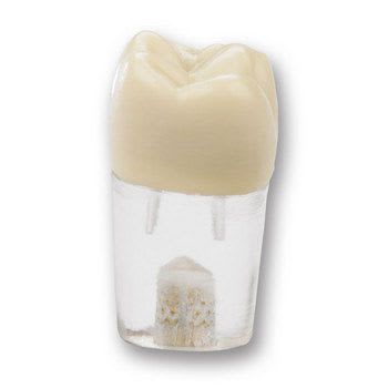 Tooth anatomical model IV-EP-ENDO #3 Columbia Dentoform®