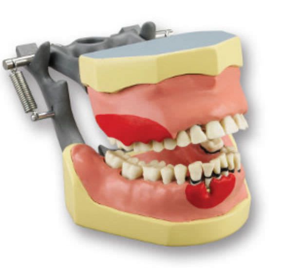 Denture anatomical model KM-210 (C) Columbia Dentoform®