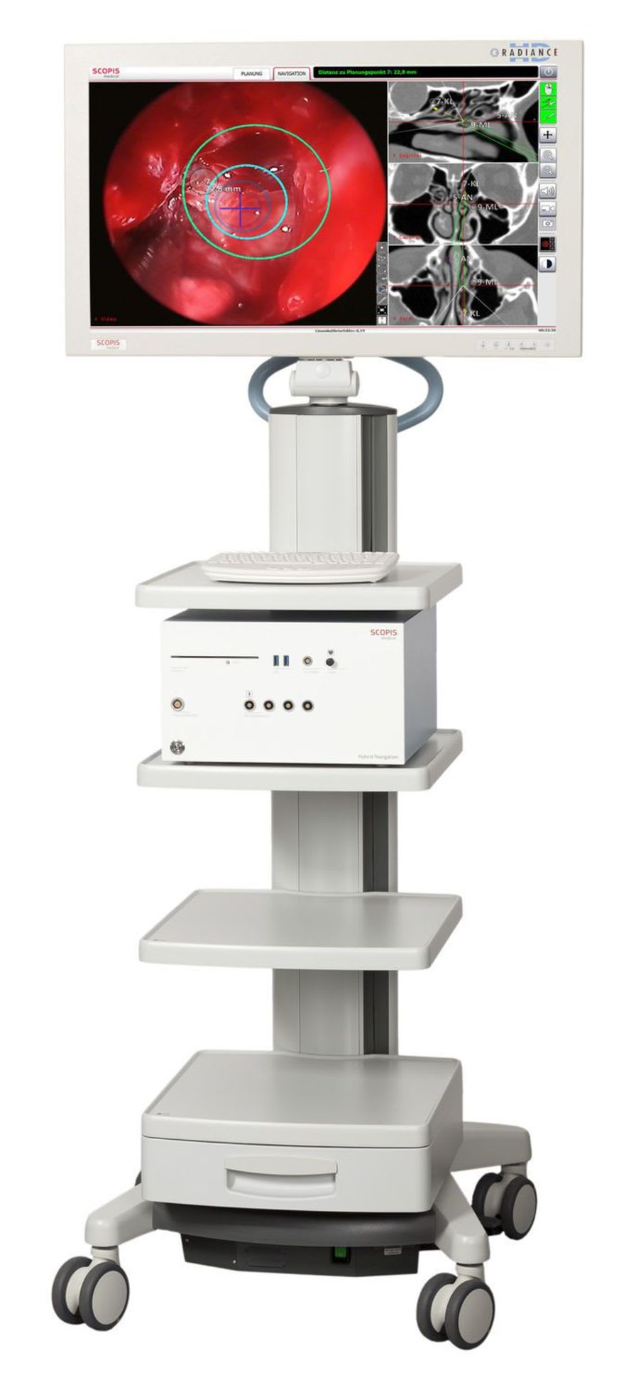 Optical surgical navigation system / for ENT surgery / for neurosurgery / for maxillofacial surgery Scopis® Navigation Scopis