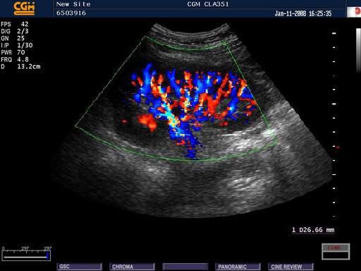 Ultrasound system / on platform, compact / for gynecological and obstetric ultrasound imaging OPUS Series Chang Gung Medical Technology