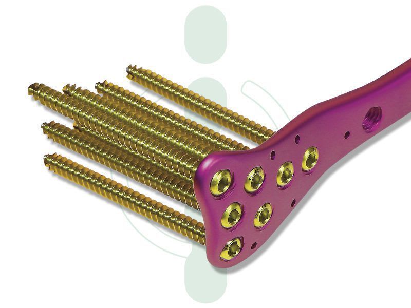 Femur compression bone plate / distal INTERCUS