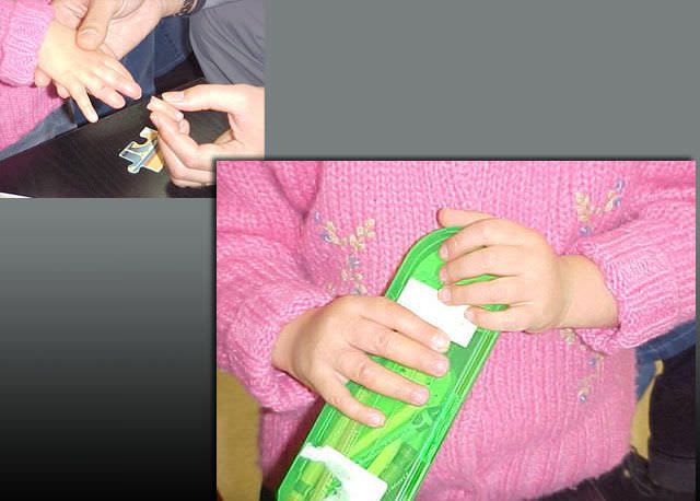 Pediatric external cosmetic prosthesis / finger PHP aesthetic prostheses