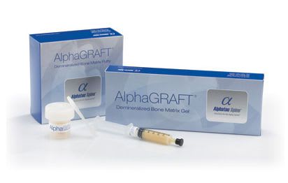 Bone cement ALPHAGRAFT® Alphatec Spine