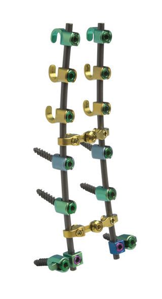 Cervico-thoracic spinal osteosynthesis unit / posterior SOLANAS® Alphatec Spine
