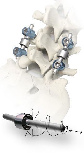Thoraco-lumbar semi-rigid spinal osteosynthesis unit / posterior / human ISOBAR® Alphatec Spine