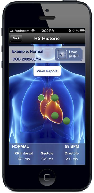 Cardiac iOS application / teleconsultation Diacoustic Medical Devices (DMD)