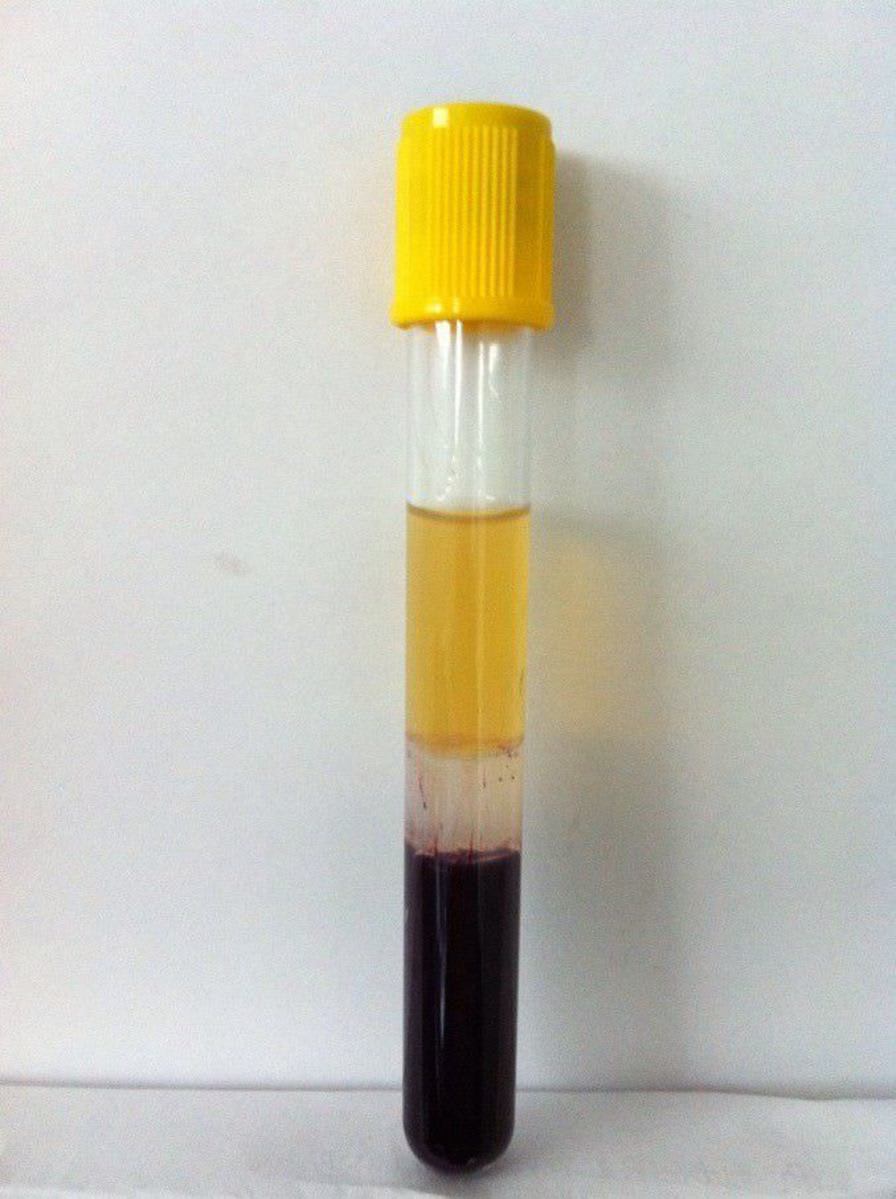 Serum analysis collection tube / separator gel / coagulation activator Beijing Hanbaihan Medical Devices Co.,LTD