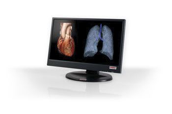 LCD display / medical 19" - 72 " Esinomed