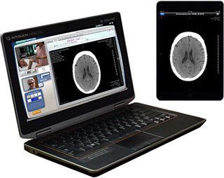 Diagnostic software / viewing / for telemedicine / for PACS SurePACS® InTouch Health
