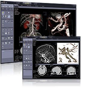 Diagnostic software / 3D viewing / medical imaging / for hospitals Xelis 3D Infinitt Healthcare Co., Ltd.