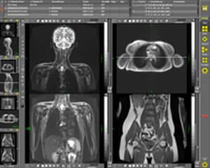 Medical computer workstation / recessed Start, Basic, Report, Java Standalone CHILI Digital Radiology