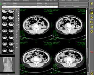 Acquisition web application / viewing / diagnostic / sharing CHILI Digital Radiology