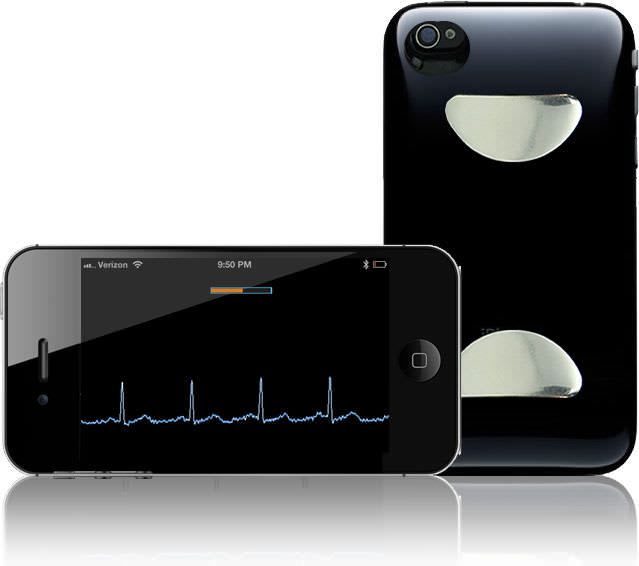 Telemonitoring iOS application / cardiac ECG Check CardiacDesigns