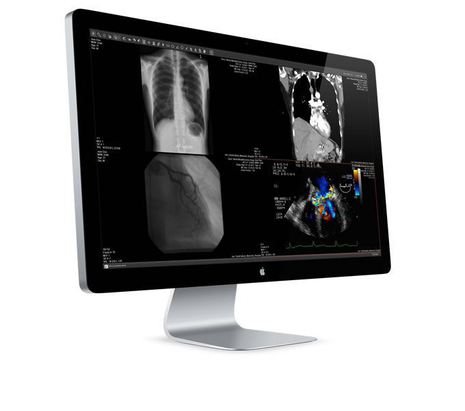Viewing software / diagnostic / medical imaging / medical eUnity™ Client Outlook, Inc.