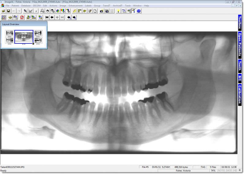 Medical software / for dental imaging IMAGEXL XLDent