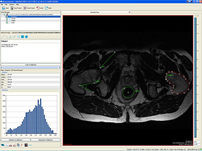 Viewing software / diagnostic / medical / medical imaging MITK 3M3 Mint Medical