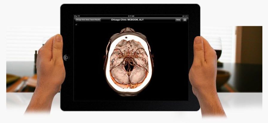 Medical imaging iOS application ResolutionMD™ Calgary Scientific
